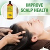 image:imagePure Cold Pressed Castor Oil  Big 32 fl oz Bottle  Unrefined amp Hexane Free  100 Pure Castor Oil for Hair Growth Thicker Eyelashes amp Eyebrows Dry Skin Healing Hair Care Joint and Muscle PainRosemary