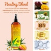 image:imageSeven Minerals NEW After Sun Solar Recovery Spray with Aloe Vera  For Skin amp Face with Instant Sunburn Relief Unlike Regular Aftersun Spray With Mango amp Chamomile 12 Oz